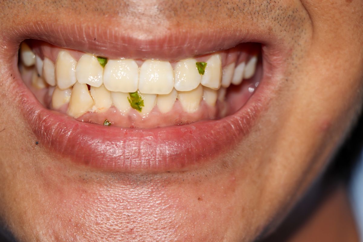 emergency dentist chandler az